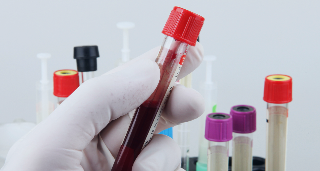 Lab-Technologies-is-Best-Lab-Equipment-Suppliear-With-17-years-of-experiance-in-kolkata-west-bengal-and-east-part-of-india-110325 60